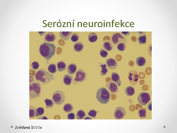 Serózní neuroinfekce Zvětšení 1000 x 