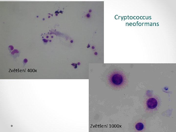 Cryptococcus neoformans Zvětšení 400 x Zvětšení 1000 x 
