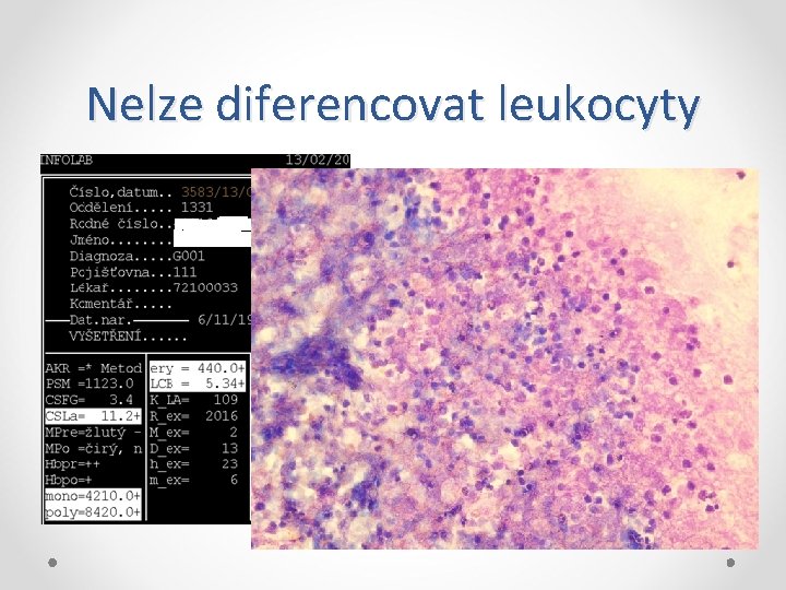 Nelze diferencovat leukocyty 