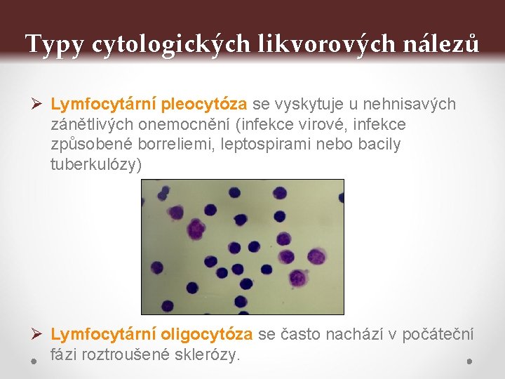 Typy cytologických likvorových nálezů Ø Lymfocytární pleocytóza se vyskytuje u nehnisavých zánětlivých onemocnění (infekce