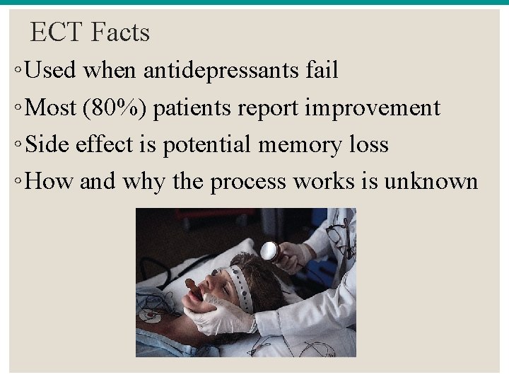 ECT Facts ◦ Used when antidepressants fail ◦ Most (80%) patients report improvement ◦