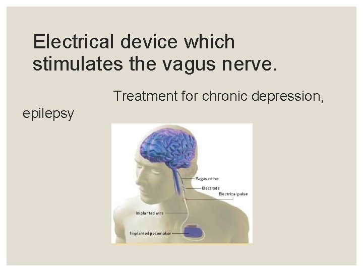 Electrical device which stimulates the vagus nerve. Treatment for chronic depression, epilepsy 