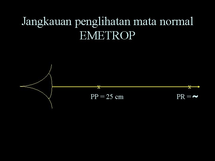 Jangkauan penglihatan mata normal EMETROP X PP = 25 cm X PR = 