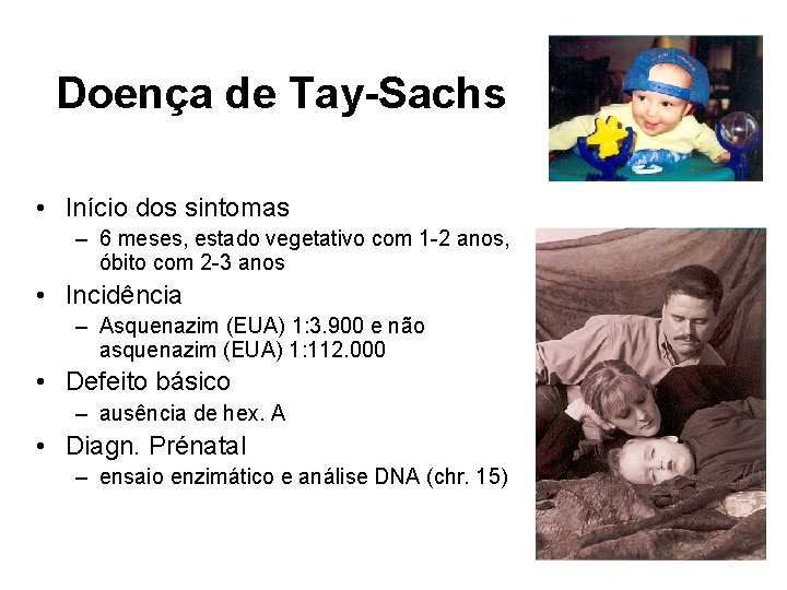 Doença de Tay-Sachs • Início dos sintomas – 6 meses, estado vegetativo com 1