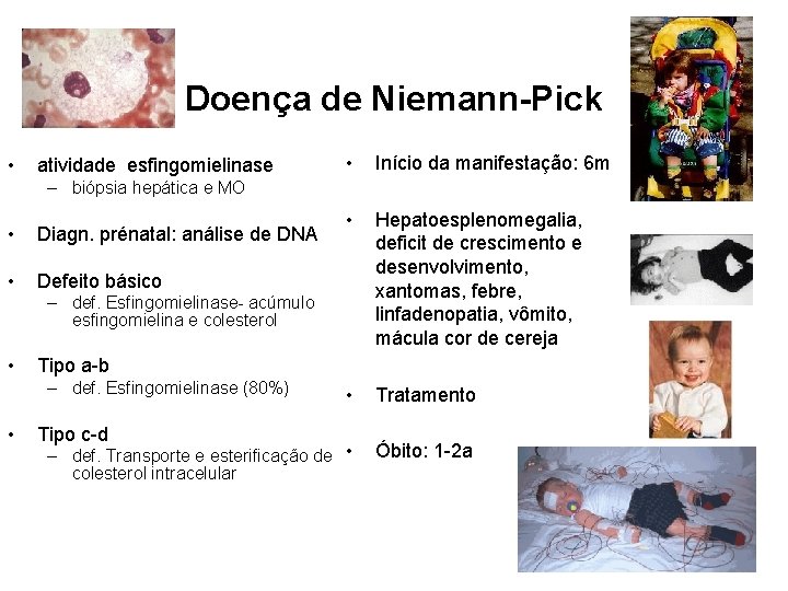 Doença de Niemann-Pick • • Início da manifestação: 6 m • Hepatoesplenomegalia, deficit de