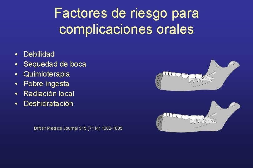Factores de riesgo para complicaciones orales • • • Debilidad Sequedad de boca Quimioterapia