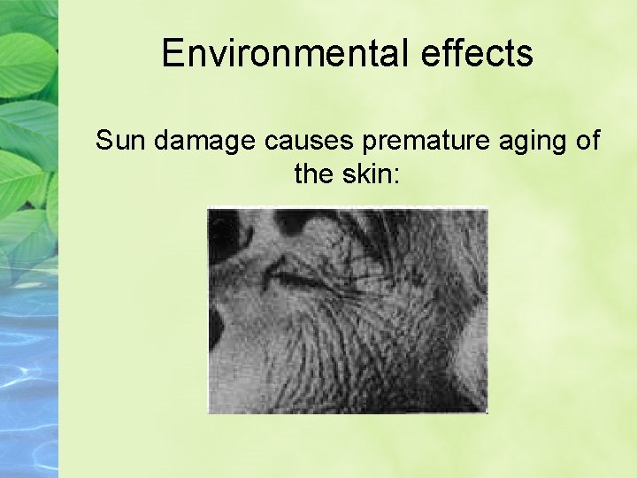 Environmental effects Sun damage causes premature aging of the skin: 