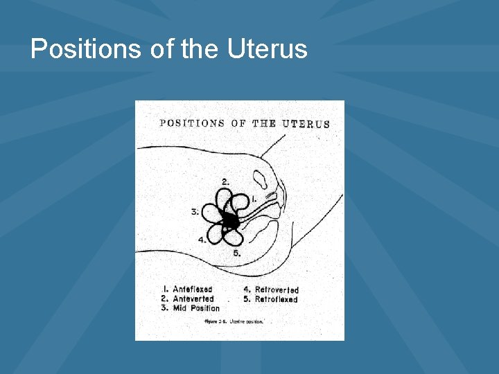 Positions of the Uterus 