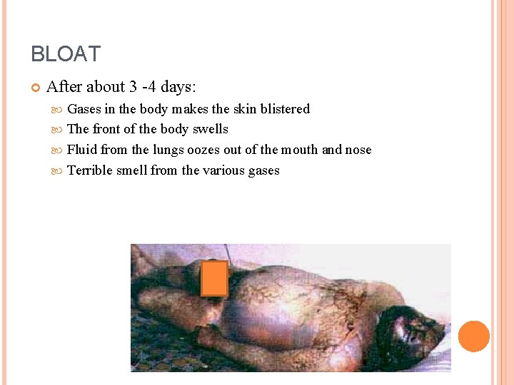 BLOAT After about 3 -4 days: Gases in the body makes the skin blistered