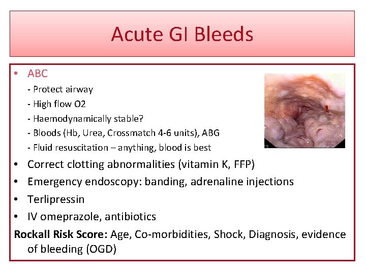 Acute GI Bleeds • ABC - Protect airway - High flow O 2 -