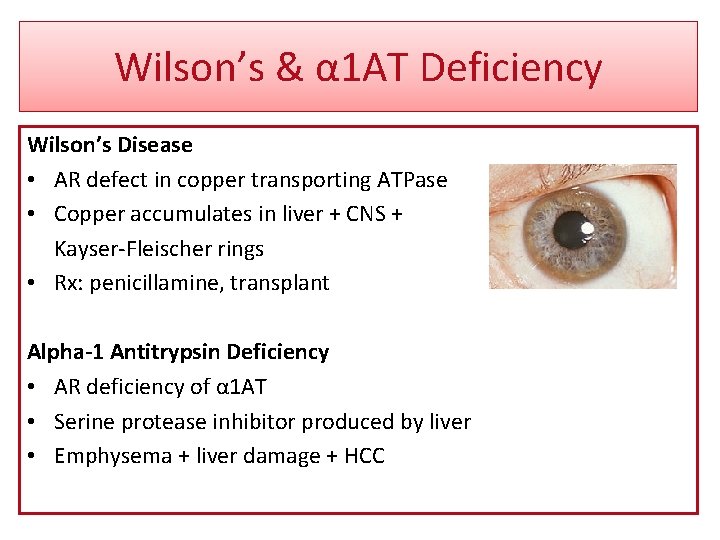 Wilson’s & α 1 AT Deficiency Wilson’s Disease • AR defect in copper transporting