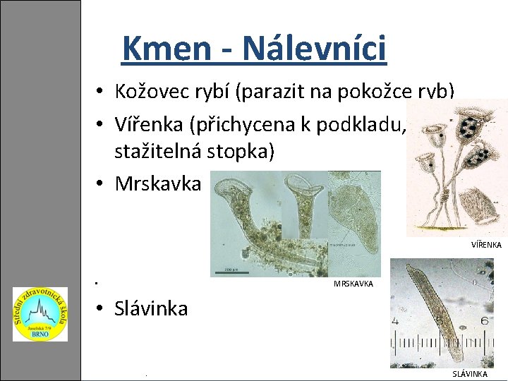 Kmen - Nálevníci • Kožovec rybí (parazit na pokožce ryb) • Vířenka (přichycena k