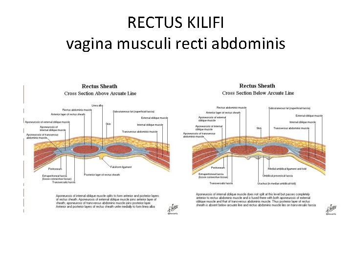 RECTUS KILIFI vagina musculi recti abdominis 
