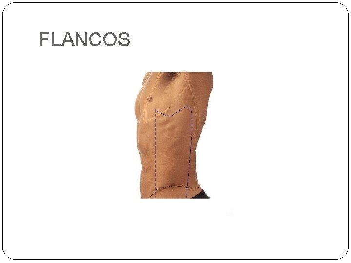 FLANCOS 