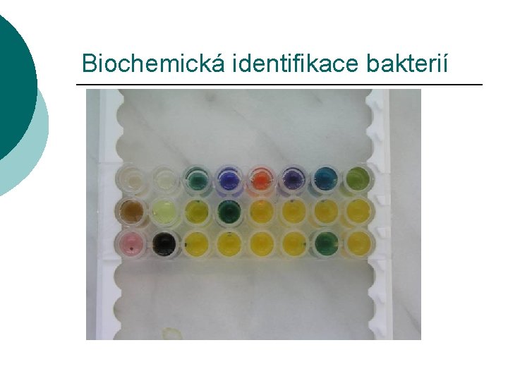 Biochemická identifikace bakterií 