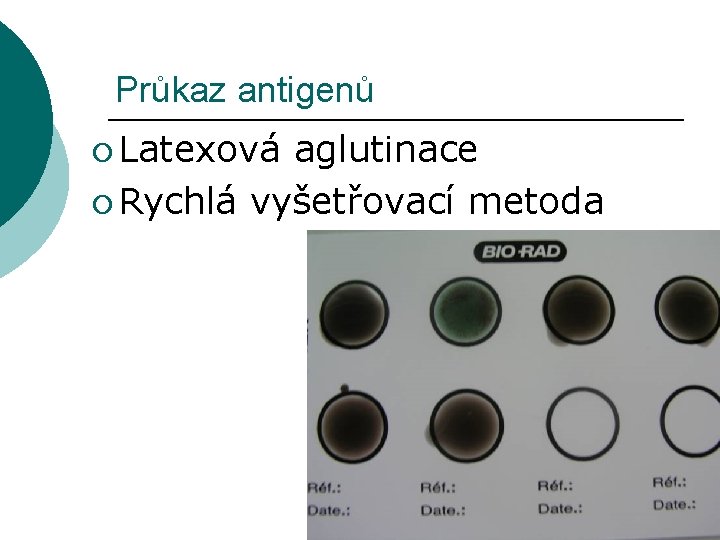 Průkaz antigenů ¡ Latexová aglutinace ¡ Rychlá vyšetřovací metoda 