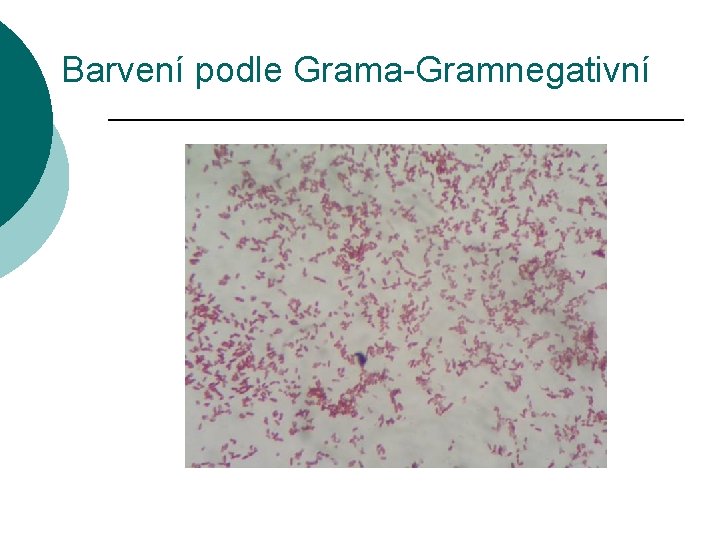 Barvení podle Grama-Gramnegativní 