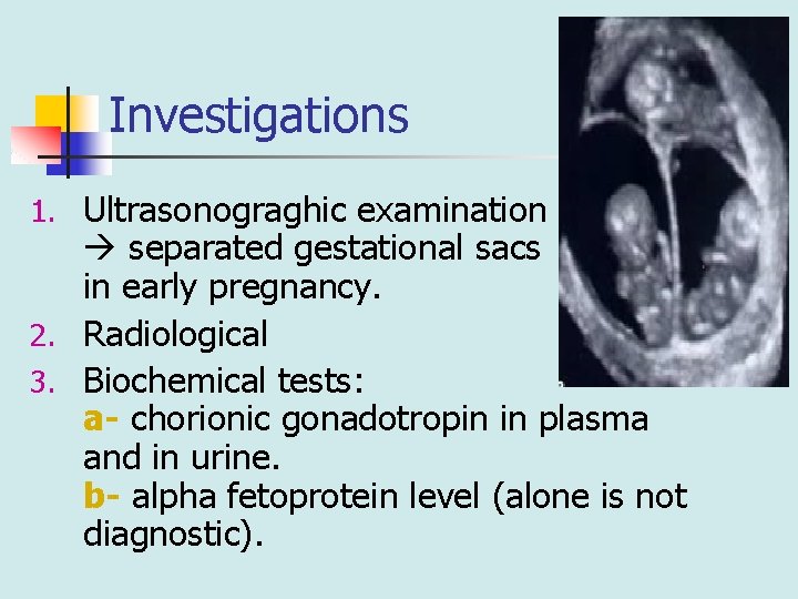 Investigations 1. Ultrasonograghic examination separated gestational sacs in early pregnancy. 2. Radiological 3. Biochemical