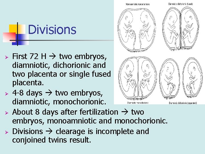 Divisions Ø Ø First 72 H two embryos, diamniotic, dichorionic and two placenta or