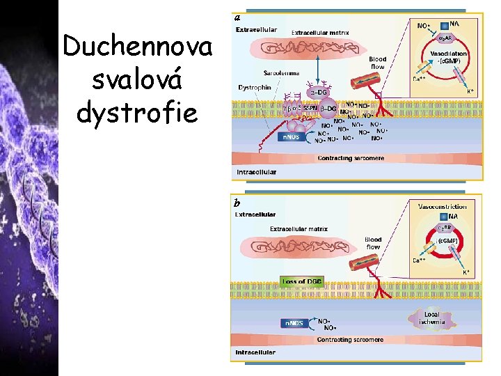 Duchennova svalová dystrofie 