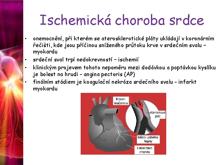 Ischemická choroba srdce • • onemocnění, při kterém se aterosklerotické pláty ukládají v koronárním