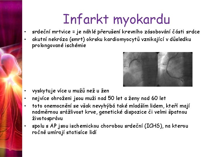 Infarkt myokardu • • srdeční mrtvice = je náhlé přerušení krevního zásobování části srdce