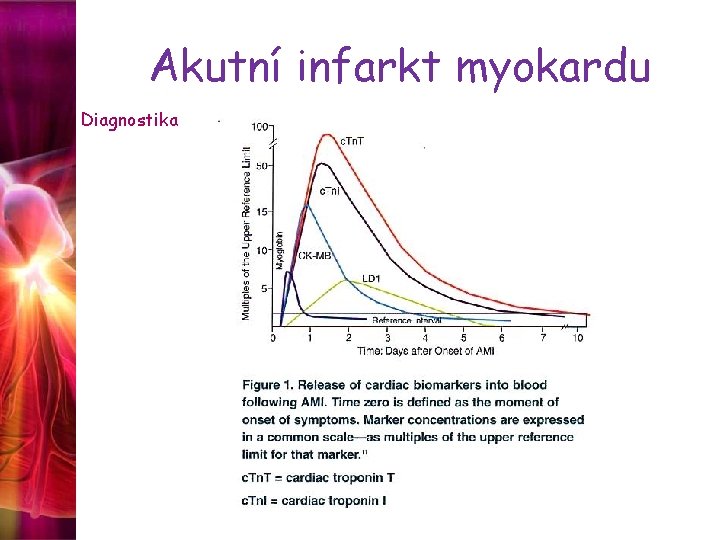 Akutní infarkt myokardu Diagnostika 