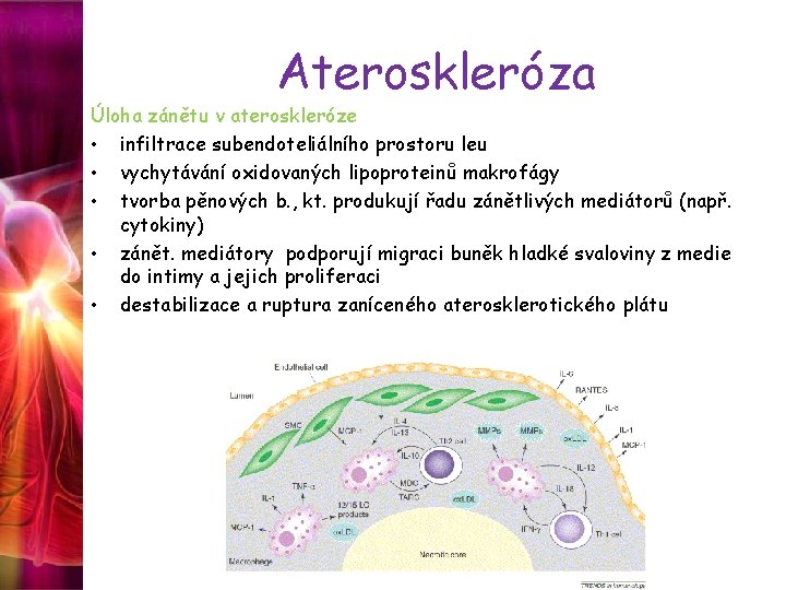 Ateroskleróza Úloha zánětu v ateroskleróze • infiltrace subendoteliálního prostoru leu • vychytávání oxidovaných lipoproteinů