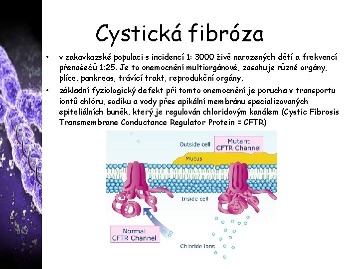 Cystická fibróza • v zakavkazské populaci s incidencí 1: 3000 živě narozených dětí a