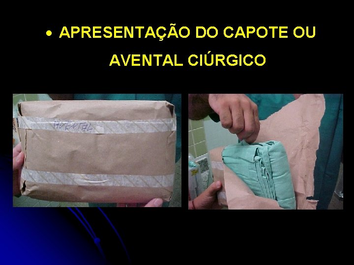 · APRESENTAÇÃO DO CAPOTE OU AVENTAL CIÚRGICO 