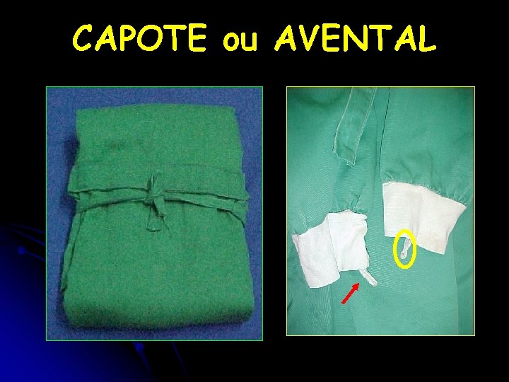 CAPOTE ou AVENTAL 