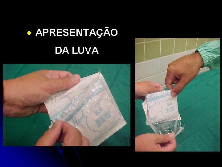 · APRESENTAÇÃO DA LUVA 