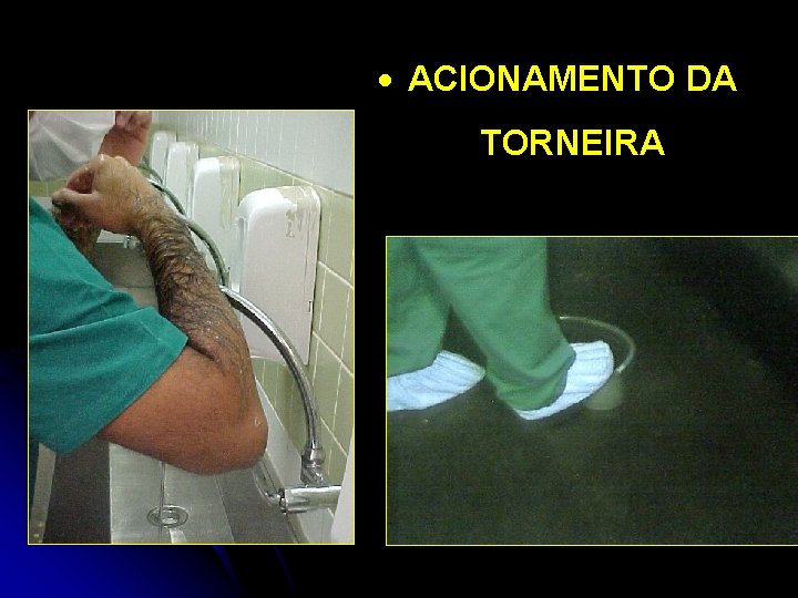 · ACIONAMENTO DA TORNEIRA 