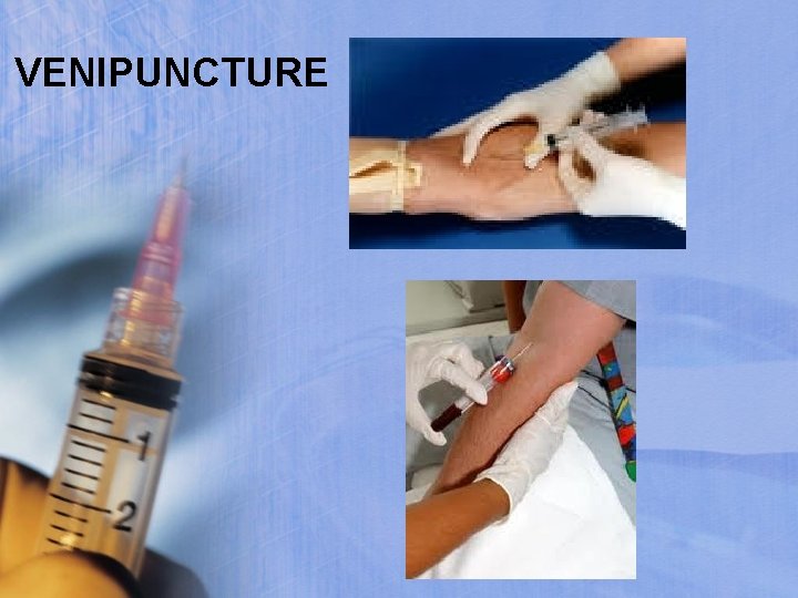 VENIPUNCTURE 