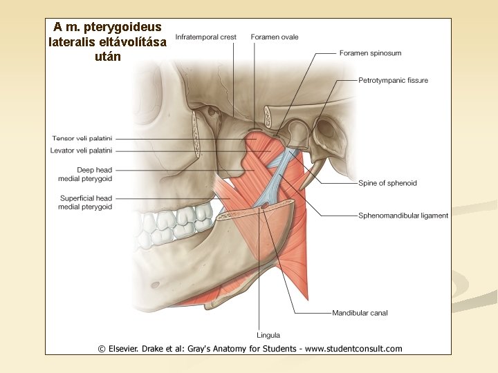 A m. pterygoideus lateralis eltávolítása után A m. pterygoideus lateralis eltávolítása után