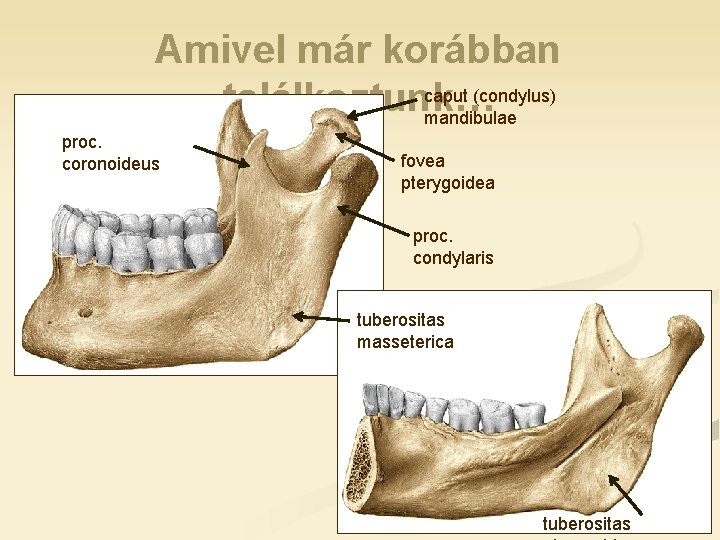 Amivel már korábban caput (condylus) találkoztunk… mandibulae proc. coronoideus fovea pterygoidea proc. condylaris tuberositas Amivel már korábban caput (condylus) találkoztunk… mandibulae proc. coronoideus fovea pterygoidea proc. condylaris tuberositas