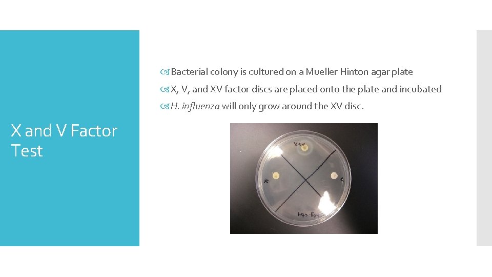  Bacterial colony is cultured on a Mueller Hinton agar plate X, V, and