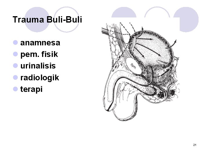 Trauma Buli-Buli l anamnesa l pem. fisik l urinalisis l radiologik l terapi 21