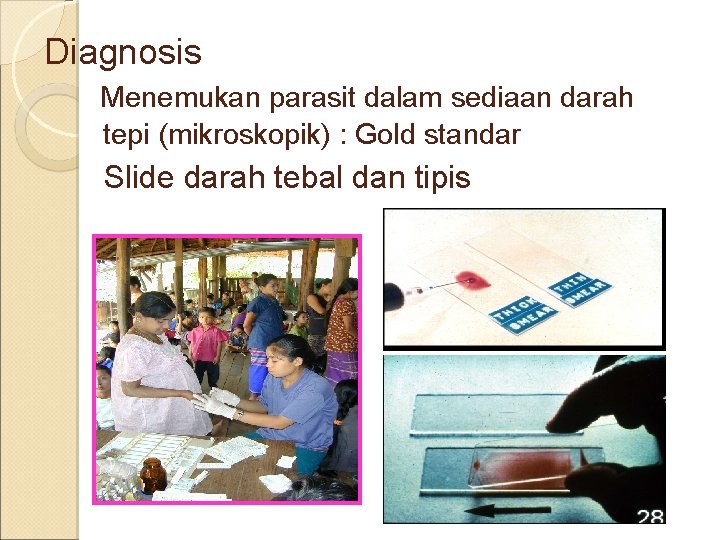 Diagnosis Menemukan parasit dalam sediaan darah tepi (mikroskopik) : Gold standar Slide darah tebal