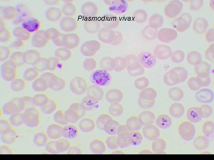 Plasmodium vivax 