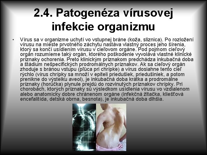 2. 4. Patogenéza vírusovej infekcie organizmu • Vírus sa v organizme uchytí vo vstupnej