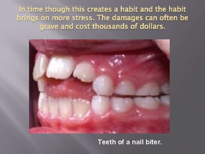 In time though this creates a habit and the habit brings on more stress.