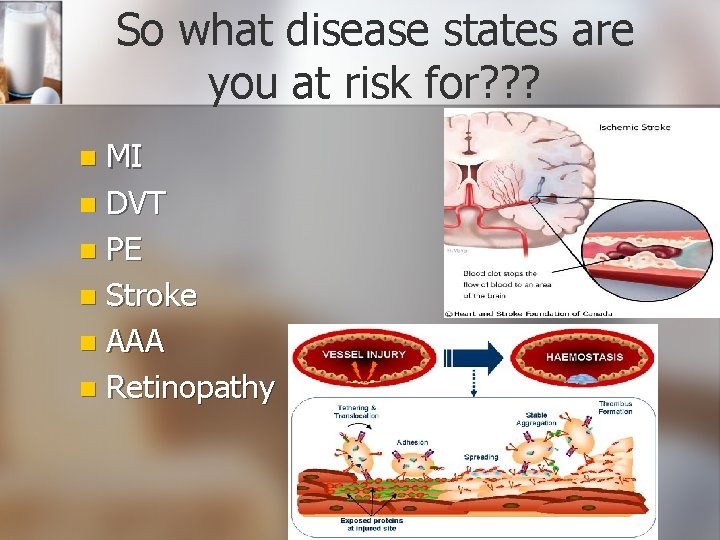 So what disease states are you at risk for? ? ? MI n DVT