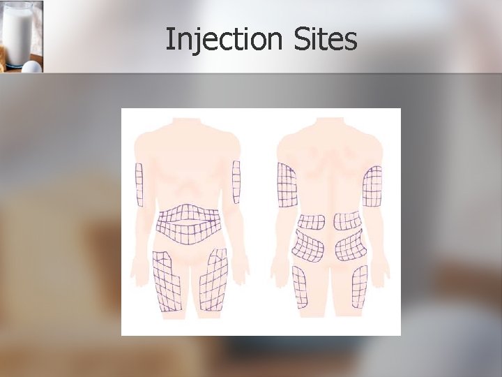 Injection Sites 