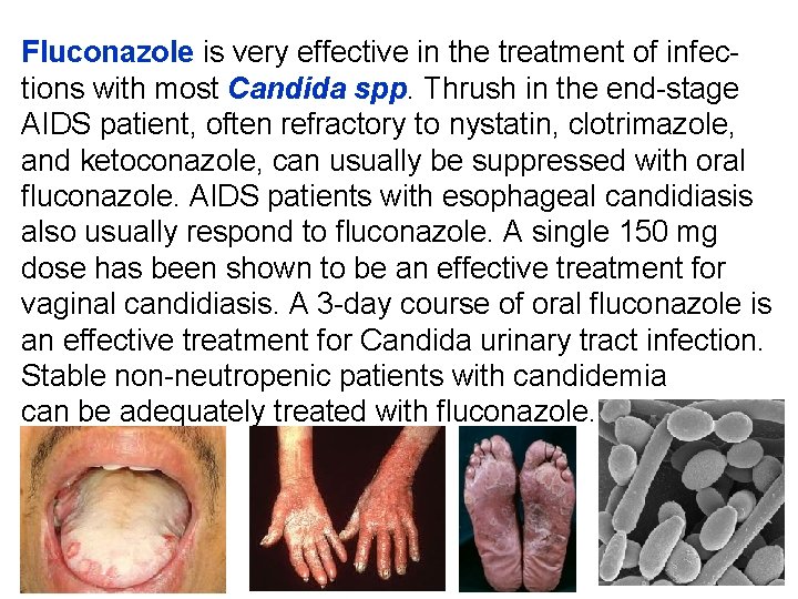 Fluconazole is very effective in the treatment of infections with most Candida spp. Thrush