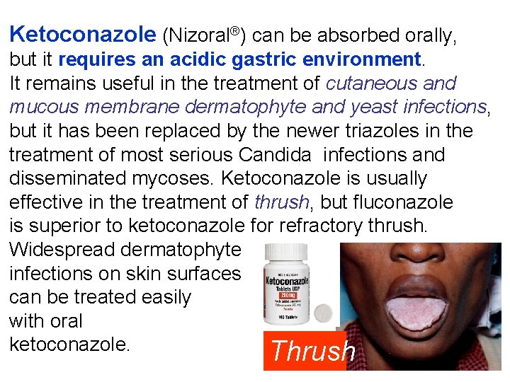 Ketoconazole (Nizoral®) can be absorbed orally, but it requires an acidic gastric environment. It