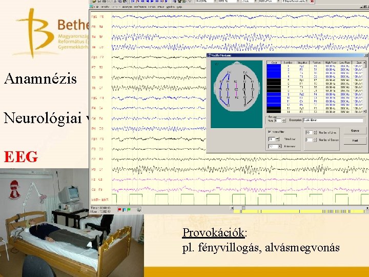 Epilepszia diagnosztika elemei Anamnézis Neurológiai vizsgálat EEG Képalkotó vizsgál Videó-EEG monit Provokációk: pl. fényvillogás,