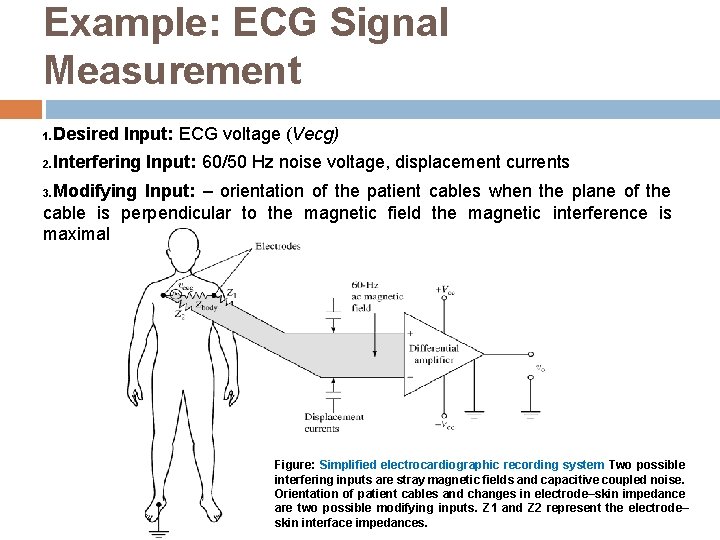 Example: ECG Signal Measurement 1. Desired Input: ECG voltage (Vecg) 2. Interfering Input: 60/50