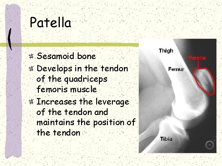 Patella Sesamoid bone Develops in the tendon of the quadriceps femoris muscle Increases the