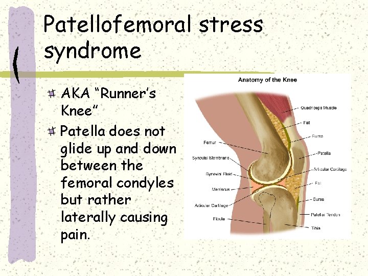 Patellofemoral stress syndrome AKA “Runner’s Knee” Patella does not glide up and down between